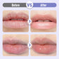 💥 Koop 1, Krijg 1 Gratis – Hydraterend Lipserum tegen Rimpels voor Volle, Zachte Lippen 💋✨